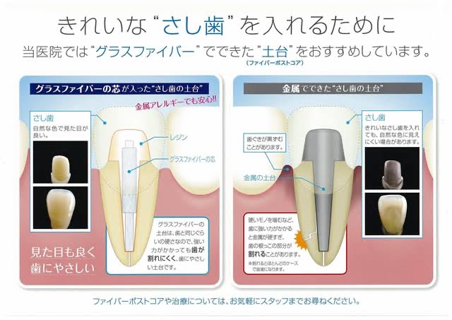 コアについて 画像